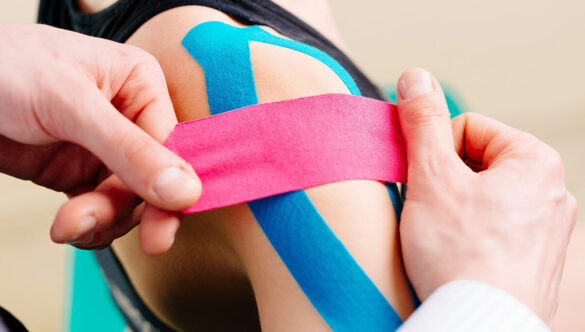 Kinesio Taping
