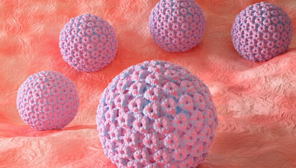 Papilloma virus (HPV)