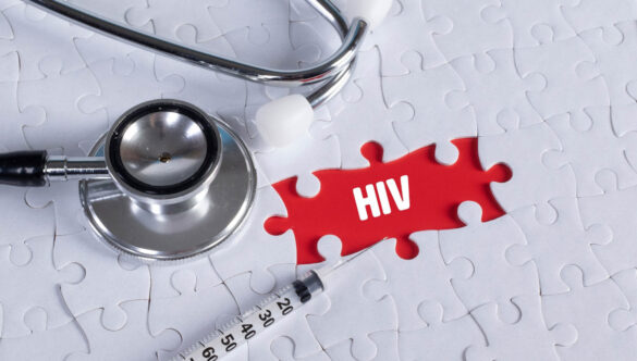 Hiv, sperimentazione vaccino