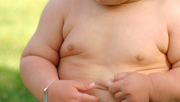 Obesità, rapporto Unicef