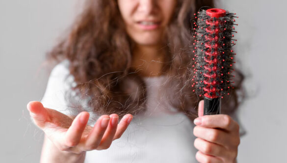 Perdita di Capelli e Cambio Stagione