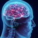 Epilessia: approfondimento