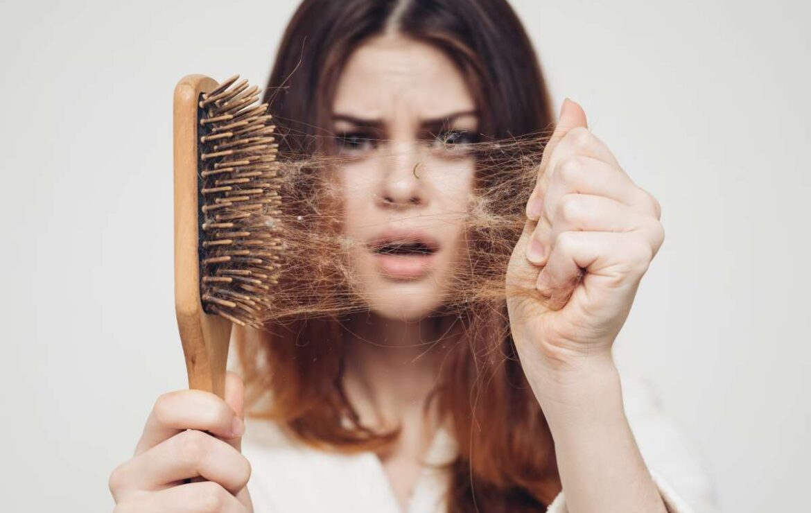 Caduta dei Capelli